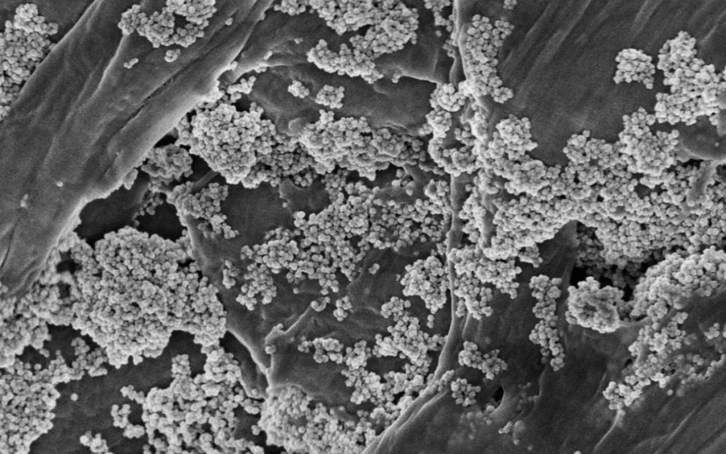 Usan nanoflores de óxido de hierro para eliminar microplásticos