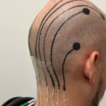 Desarrollan un tatuaje temporal capaz de medir la actividad cerebral en tiempo real