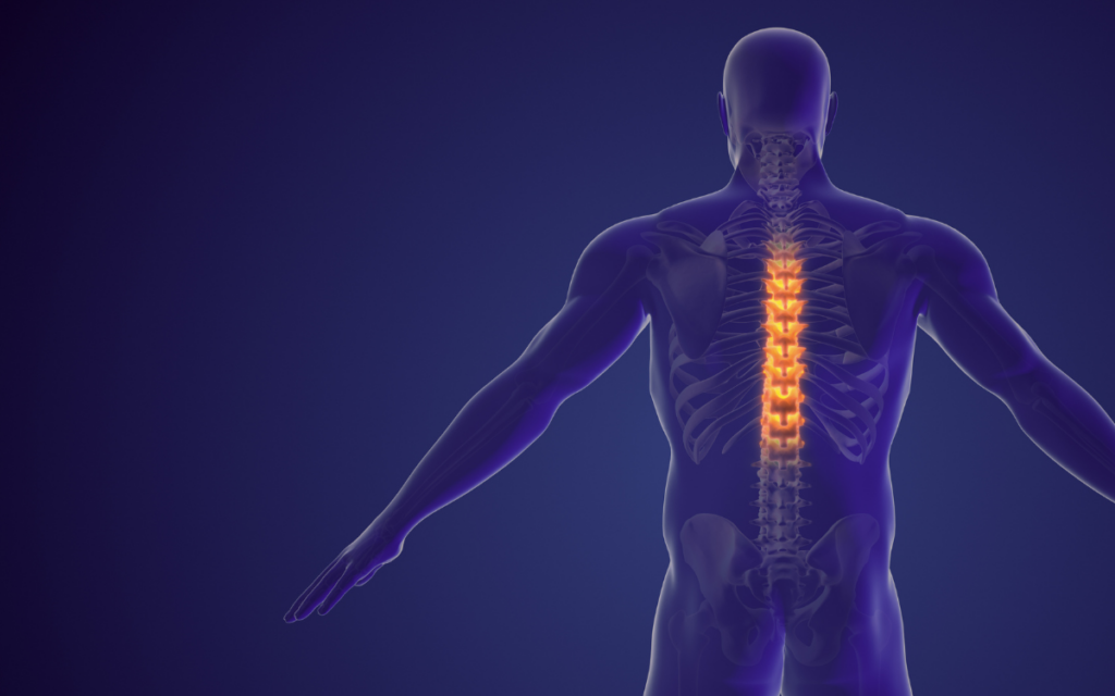Estimulación espinal de alta frecuencia para reducir la espasticidad muscular