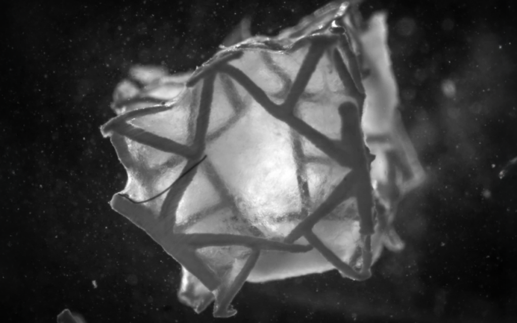 Crean un parche cardíaco biológico impreso en 3D para el corazón