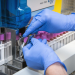 Descubren una nueva variante de hemoglobina en un hospital público madrileño
